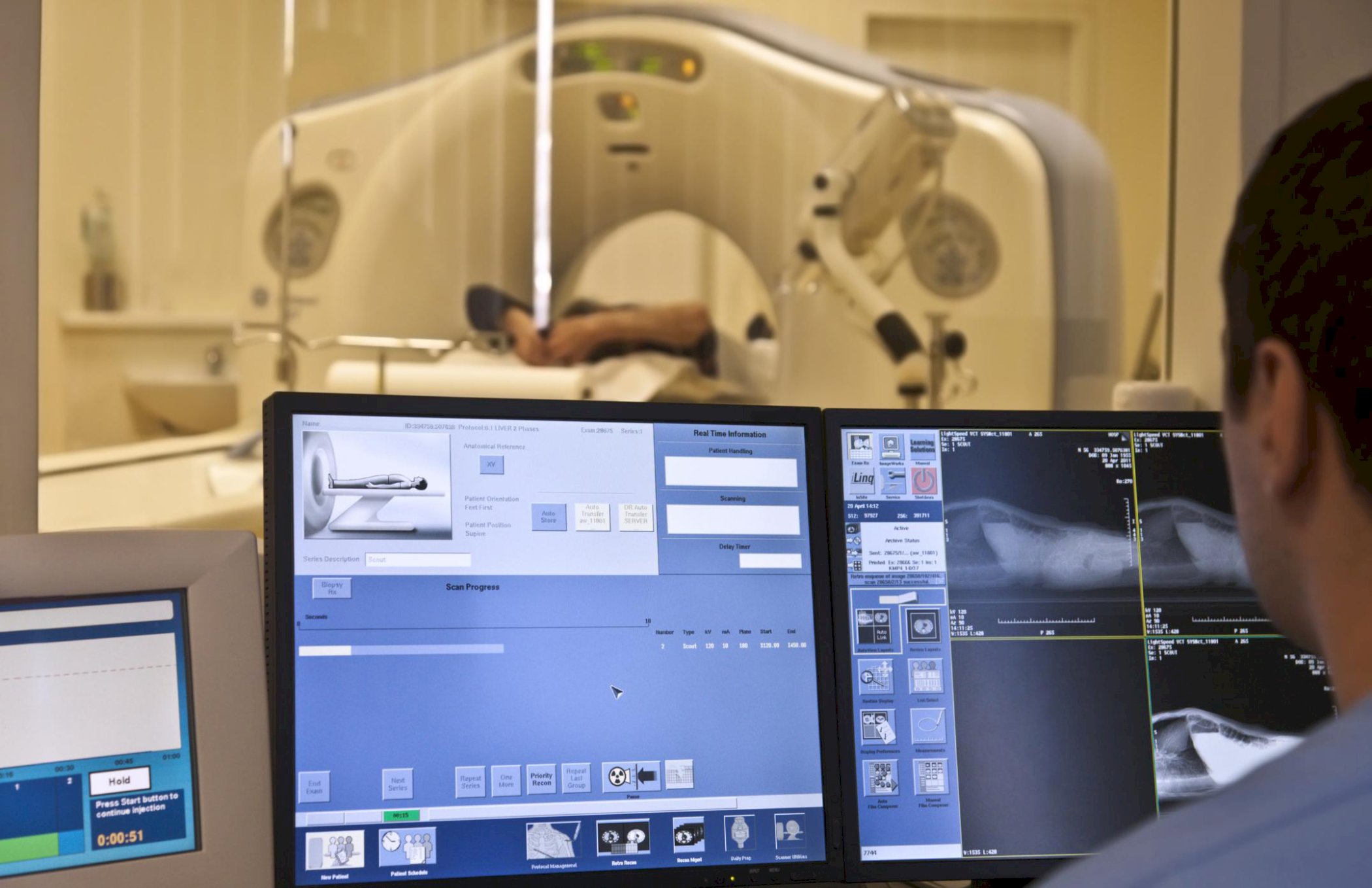 Oslo, 30. august 2019: Videregående radiologi