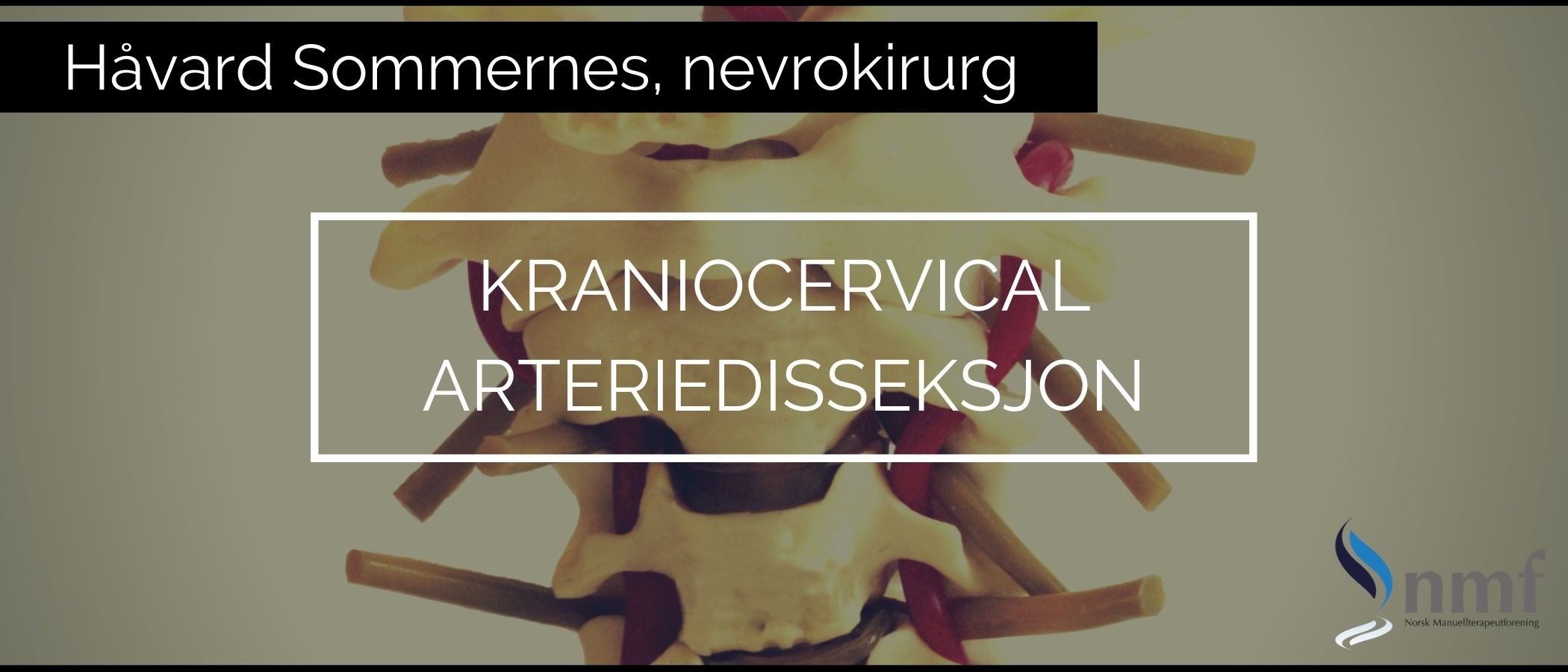 Webinar, 10. desember 2020: Kraniocervical arteriedisseksjon (CAD) - også on-demand