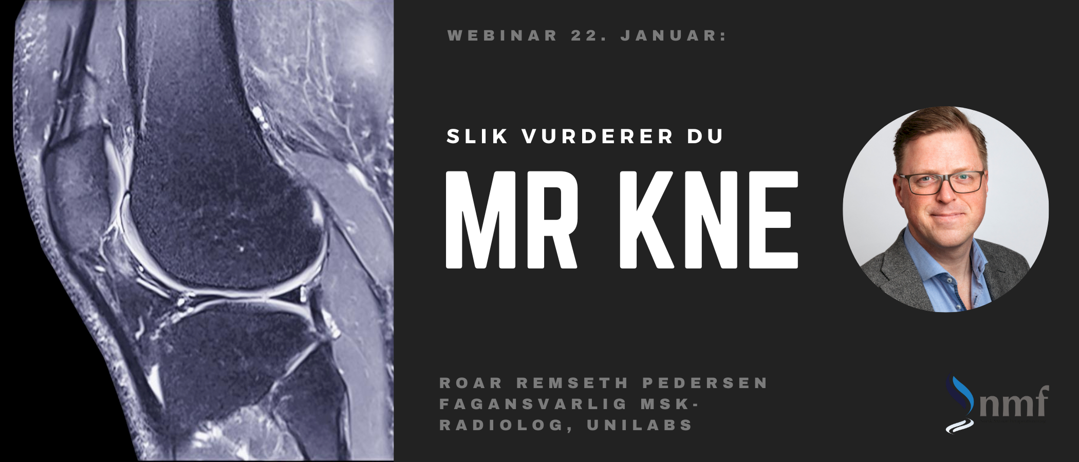 Webinar, 22. januar 2024: Slik vurderer du MR kne - også tilgjengelig i opptak!