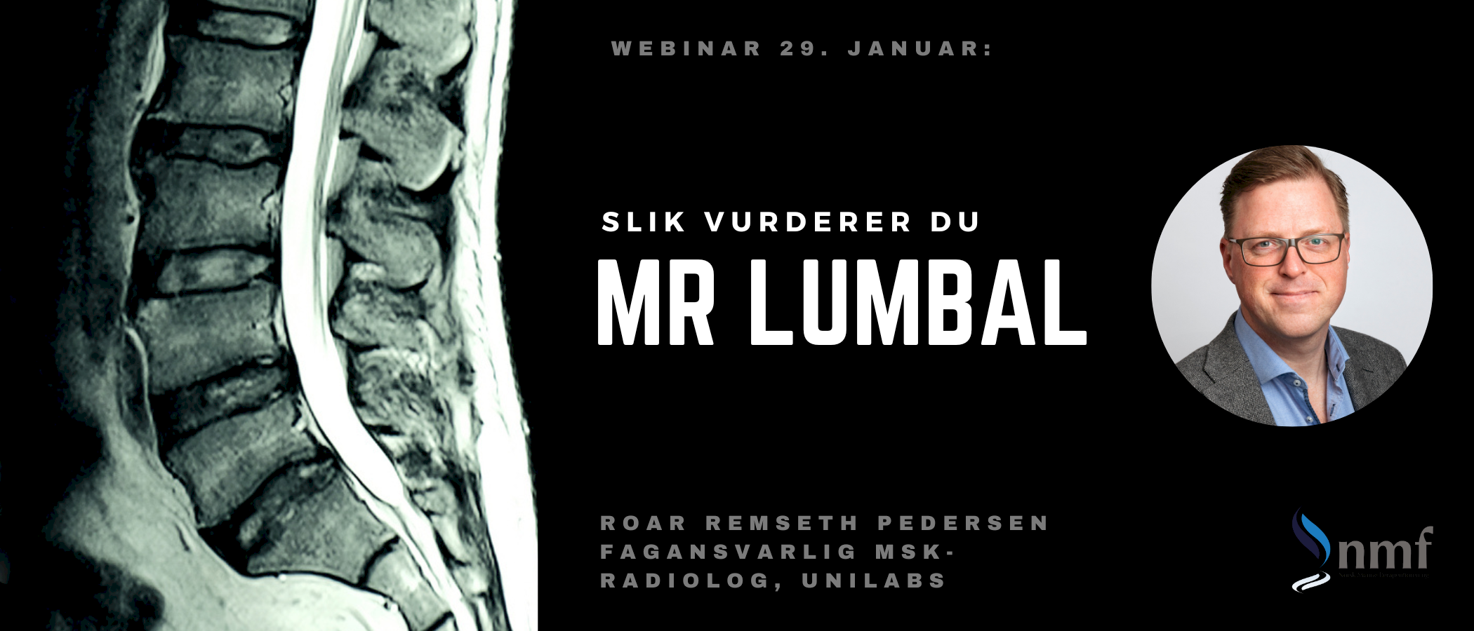 Webinar, 29. januar 2024: Slik vurderer du MR lumbal - også tilgjengelig i opptak!